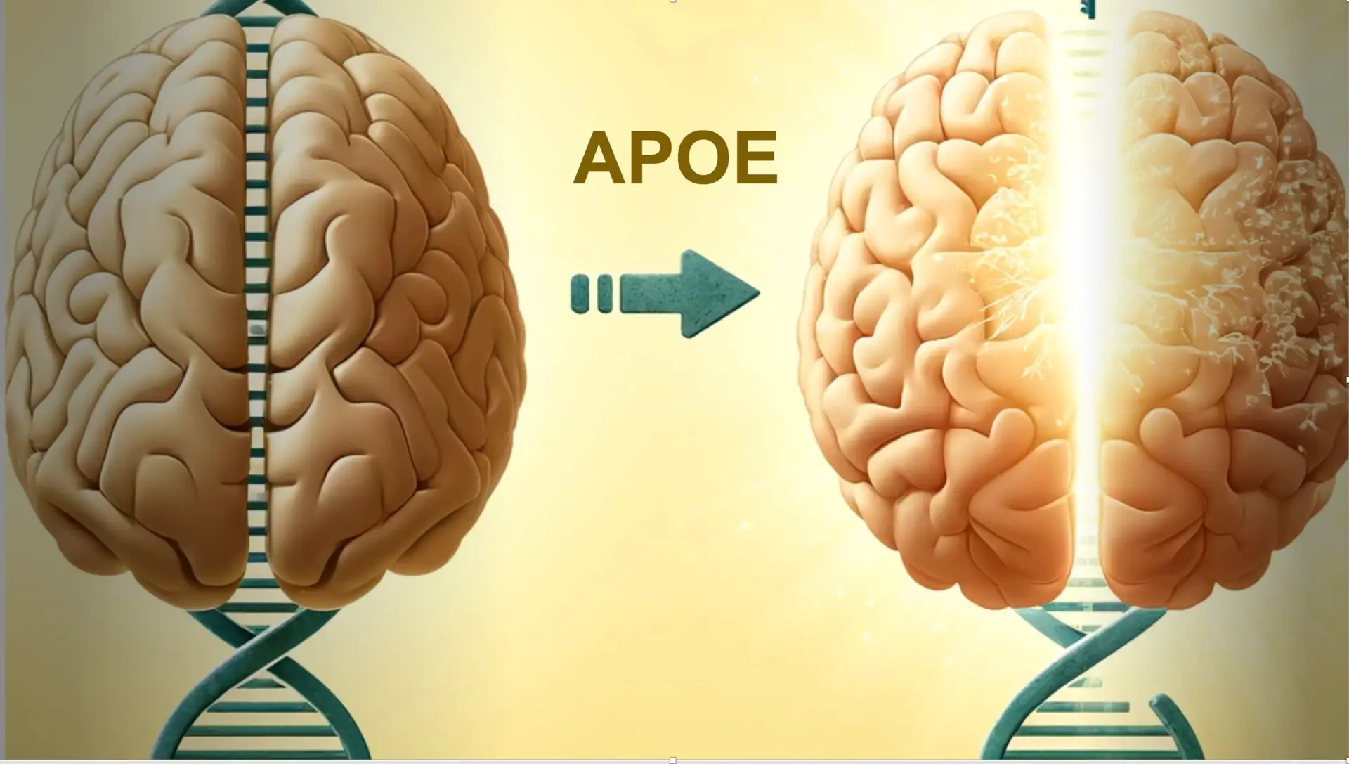 從基因角度治療阿茲海默症：降低APOE4是否能打開阿茲海默症治療的新方向
