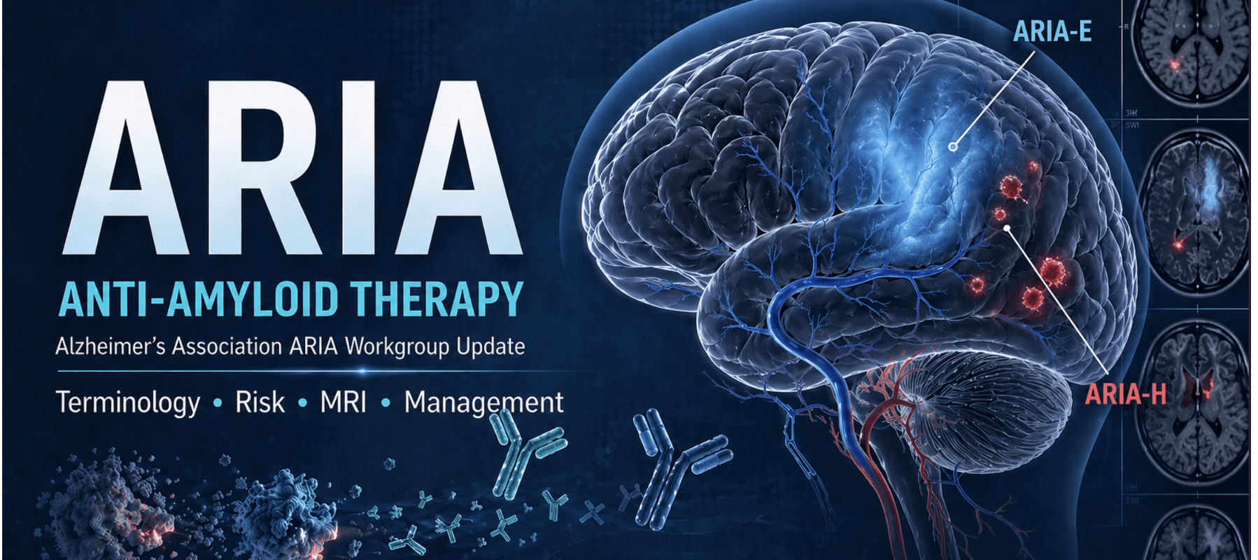 ARIA in anti-amyloid therapy for Alzheimer's disease: MRI monitoring, APOE risk, and clinical management