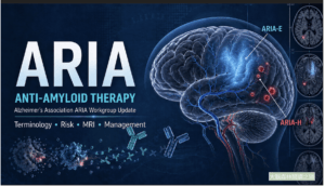 ARIA in anti-amyloid therapy for Alzheimer's disease: MRI monitoring, APOE risk, and clinical management