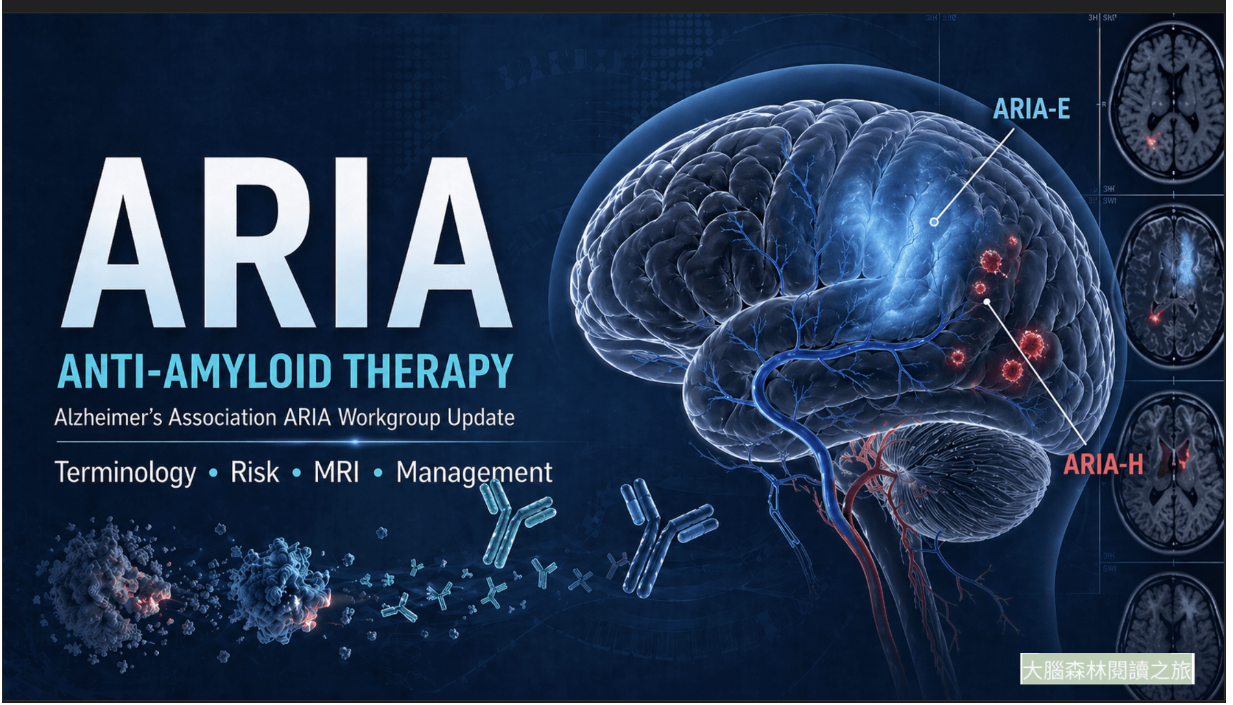 ARIA 是療效的代價，還是清除成功的訊號？從機制、風險分層到處置